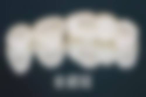 拓展延伸:種牙項目真相+關鍵選擇點+避坑指南