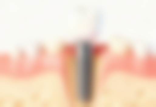 理性提醒:香港人睇牙,安心永遠排第一!