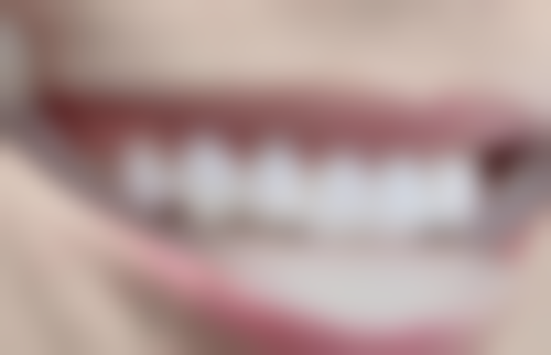 三、江苏宿迁新星修复体检开展项目及特色技术