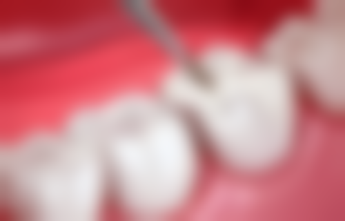 香港 澳门看牙去哪个医院好？ 价钱大对比（HKD）