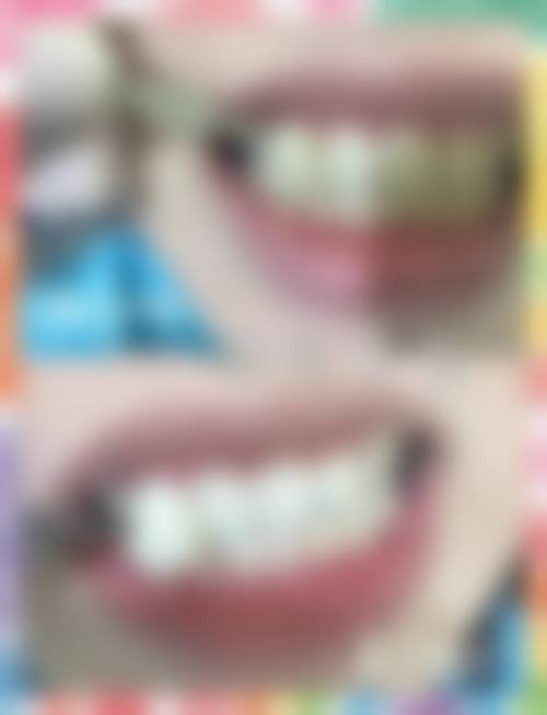 深圳篇（罗湖/福田口岸优选）