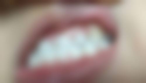 跨境看牙常见Q&A（香港姊妹更关心）