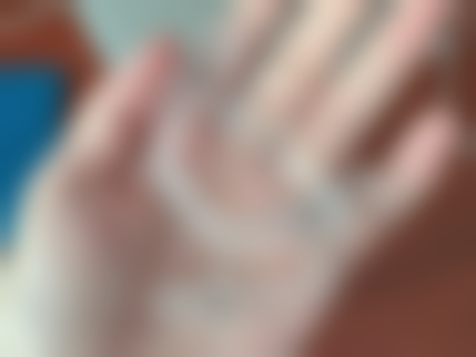 拓展延伸：跨境看牙真相+避坑指南