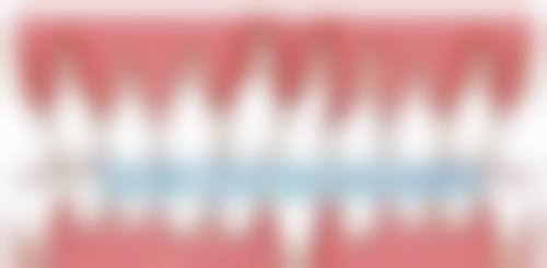 珠海箍牙 vs 香港/澳门:边个更抵?3大维度对比