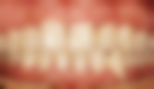 香港人过珠海箍牙:2026全新价目表大公开(附澳门对比)