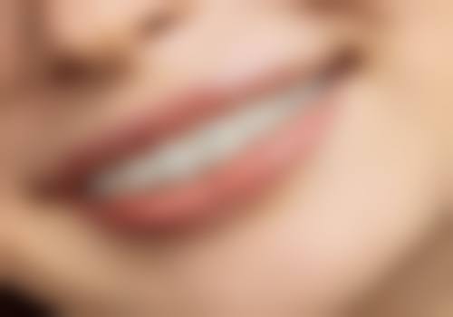 全口种植牙需要多少天完成