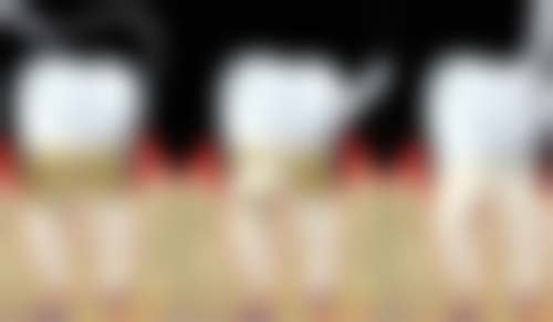 香港 在澳門看牙科貴不貴 適合邊類人群？珠海先係呢3類人首選