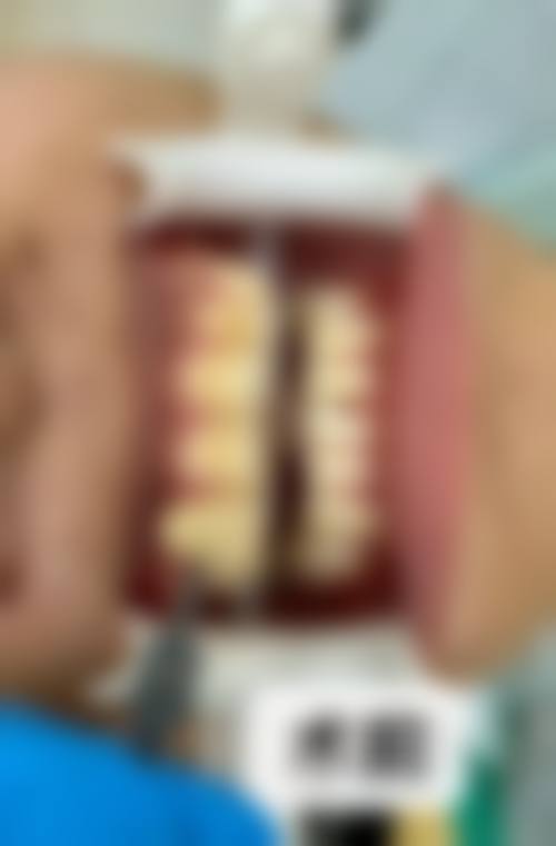 江苏盐城响水朱传贤口腔诊所特色诊疗项目