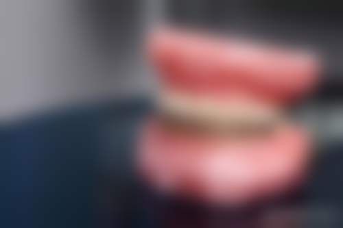 从医学角度看,儿童还没换牙补牙的核心目的是什么?