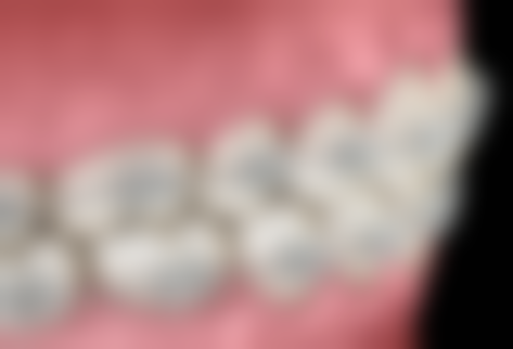 300元起拯救蛀牙危机!