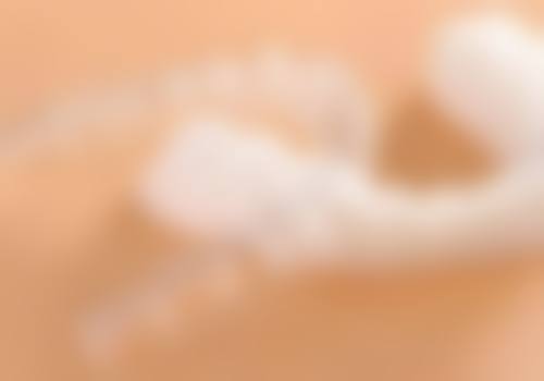 儿童牙齿矫正医院与医生的选择