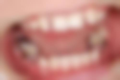 香港 澳门牙科十大排名 粤语问诊贴士