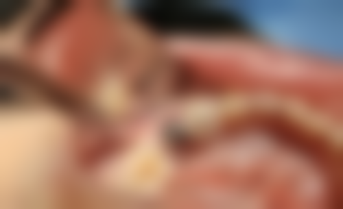 韩国登腾vs瑞士ITI：寿命/价格大比拼（香港 + 深圳口岸）