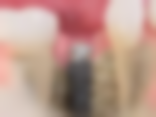 植牙术前术后避坑指南（香港生活习惯版）