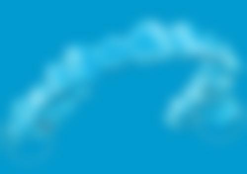 港人真實实例：銅鑼灣陳太種全口牙慳18萬，旺角張生2隻牙4000搞掂