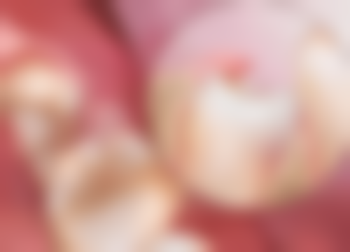 香港人去珠海睇牙避坑指南：術前術後要注意啲咩？