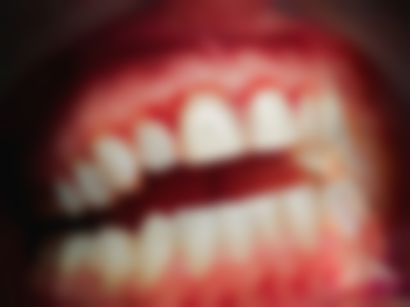 延伸閱讀：香港人睇牙常見真相+關鍵選擇點