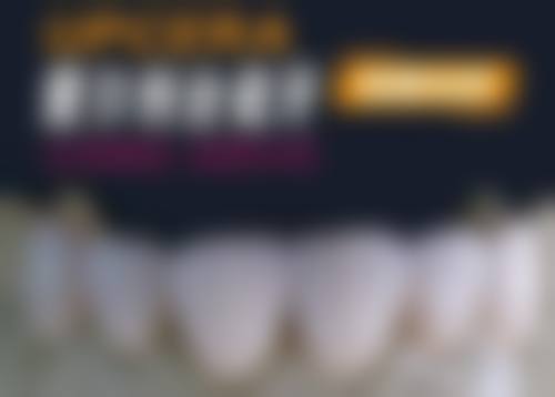 香港 格倫菲爾好唔好 牙齒矯正真實體驗：3個港女实例話你知