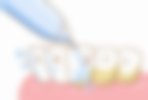 拓展延伸：香港人拱北看牙避坑指南