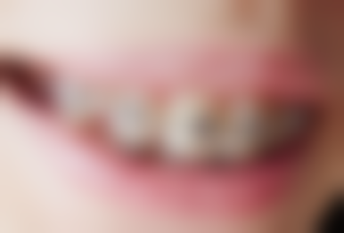 四、青岛大学医学校松山医院口腔科特色诊疗项目及技术优势