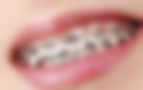 牙齿痛用药真相：香港人更易踩嘅3个误区