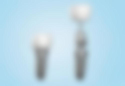 香港 種植牙過程 價錢範圍（HKD）：同深圳口岸價錢對比，邊度抵？