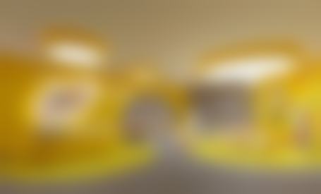 五、术后当天到一周：牙齿舒适度拉满，没有异物感