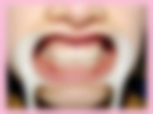 八、榆林特美口腔诊所口碑如何