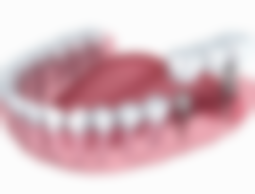 關鍵選擇點：香港人整牙必知4件事