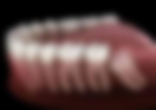 澳门牙科医院排名前十 深圳口岸诊所推介（适合香港+澳门跨城街坊）