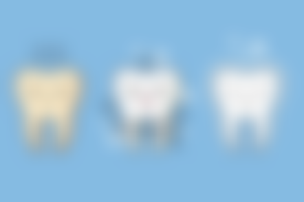 时代天使隐形矫正的技术原理是什么？