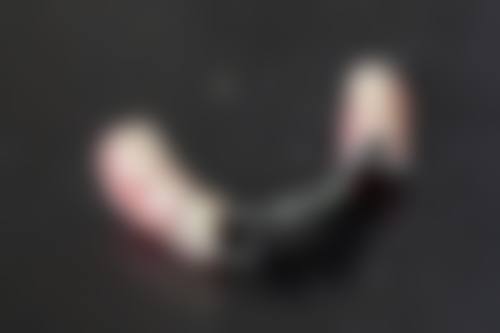 五、全瓷牙冠精细流程&术前术后服务：全程贴心靠谱！
