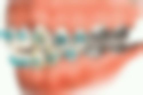 六、牙齿矫正后复查有哪些项目？