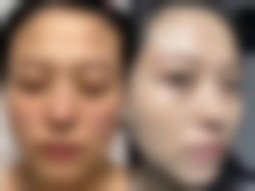 上海尊然医院皮肤美容科24小时电话服务
