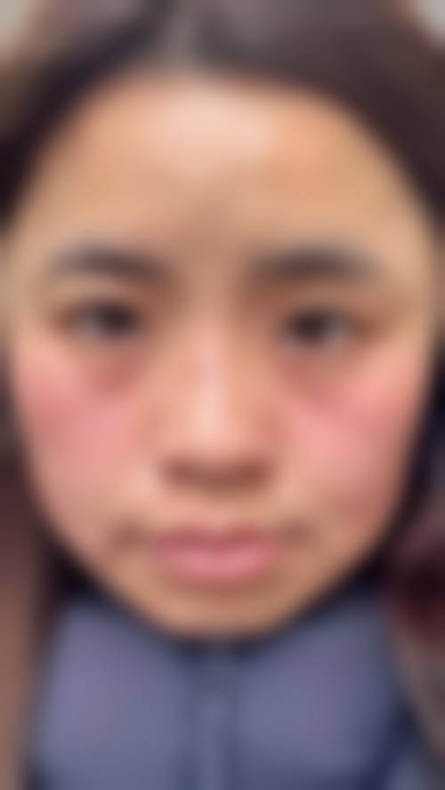 上海尊然医院皮肤美容科诊疗项目