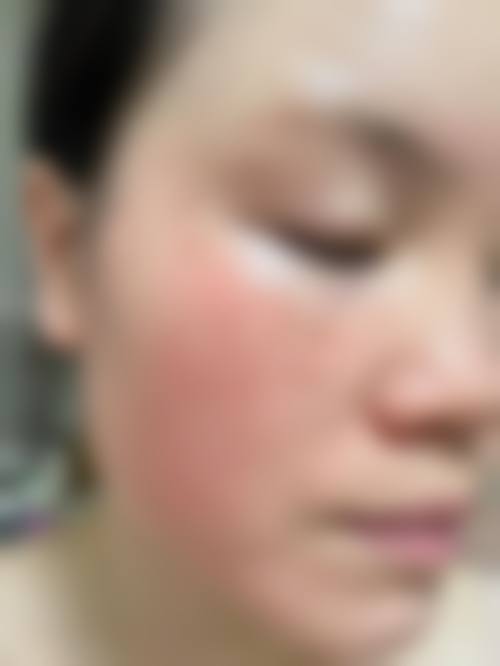 上海尊然医院皮肤美容科特色技术优势及特色技术服务