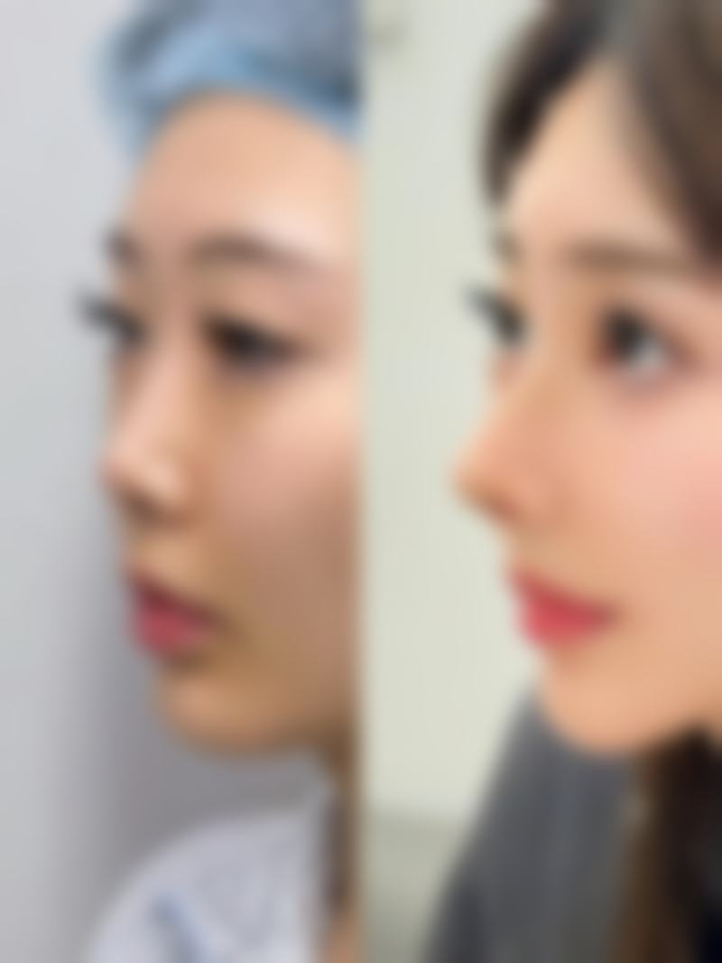 1、口碑与评价参考