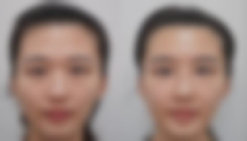 十三、黑龙江中航医院腋臭科口碑评价