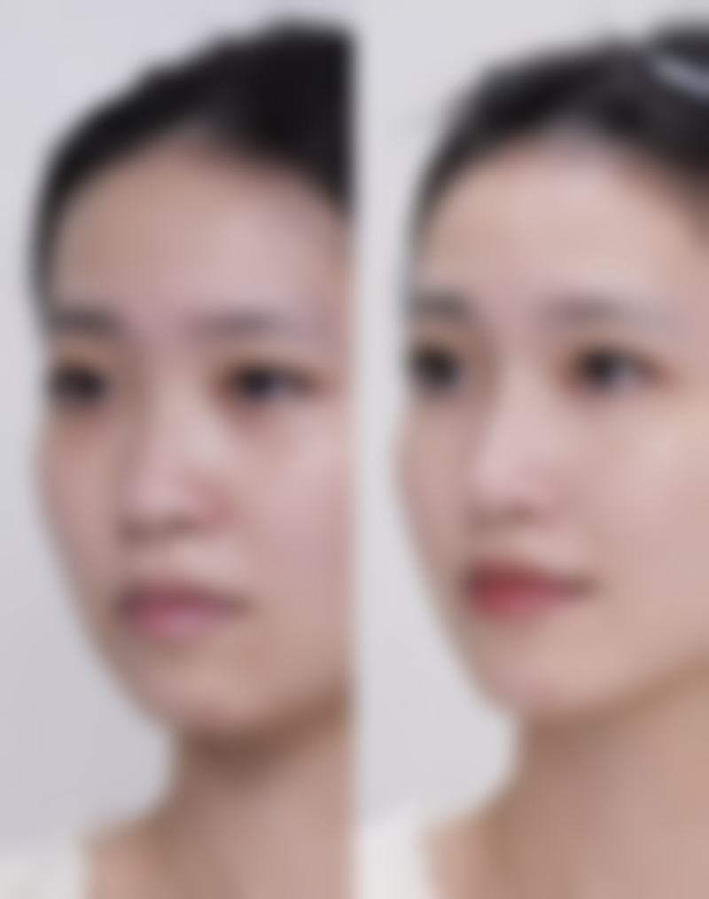 2、【皮肤美容诊疗】核心技术优势