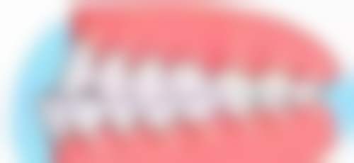 为什么骨干医生建议8岁用扩弓器纠正地包天？优势明显