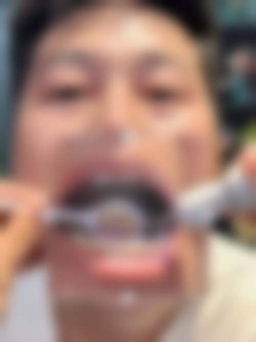 三、张世坤医生技术水平高