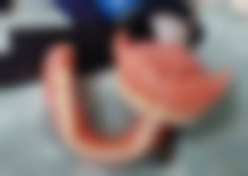 全瓷牙冠術前術後避坑指南：香港生活習慣版