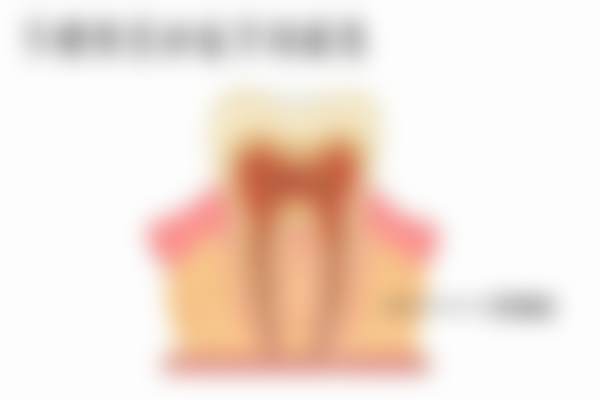 美云口腔数字化种牙与隐形矫正价格表2025年全新版