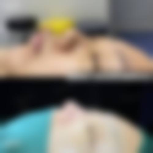 西宁友健整形医院埋线双眼皮技术优势
