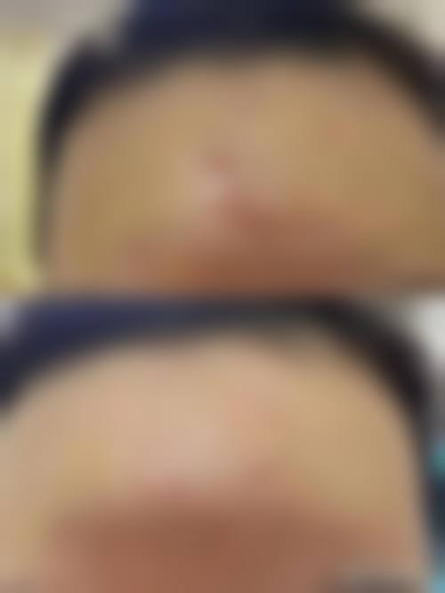 十、患者常见问题解答（精选 ）