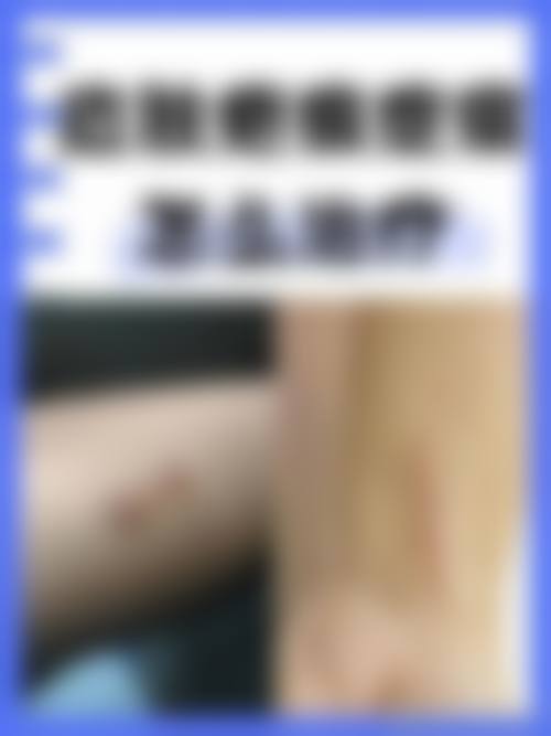 八、患者常见问题解答（精选 ）