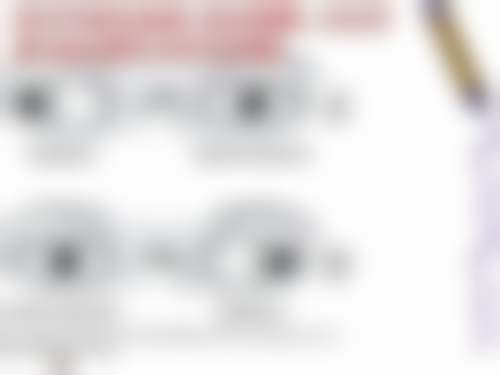 2、【青光眼治疗】核心技术优势