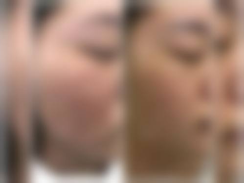六、濉溪县医院(烧伤整形外科)美容缝合技术优势