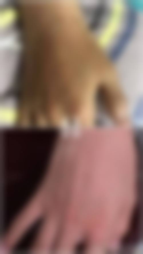 七、�溪县医院(烧伤整形外科)医生介绍