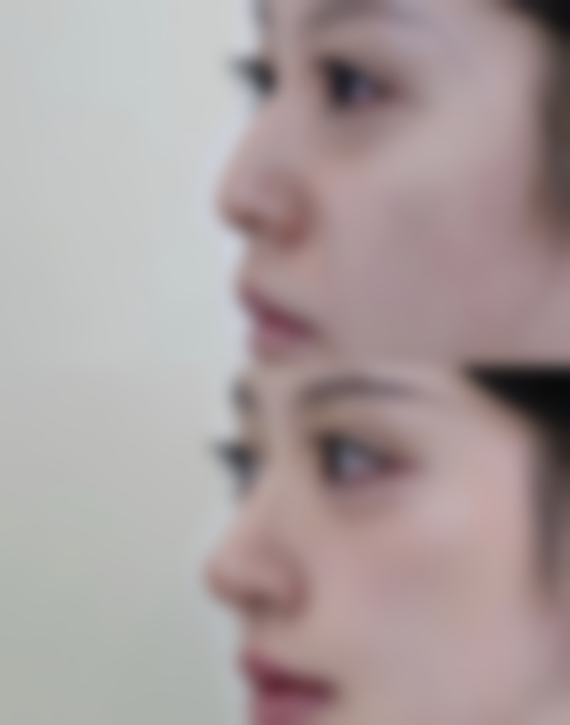 拓展延伸:韓國江南jiwoo醫美項目真相+避坑指南